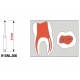 Alesatore endodontico alta capacitˆ di taglio a pallina 008 (5pz)