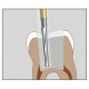 Fresa endodontica con tagliente lungo - dentatura taglio trasversale 016 (3pz)